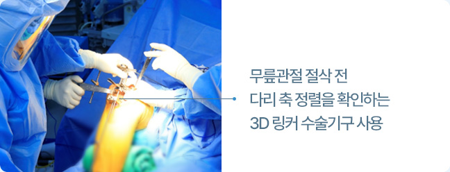 무릎관절 절삭 전 다리 축 정렬을 확인하는 3D 링커 수술기구 사용